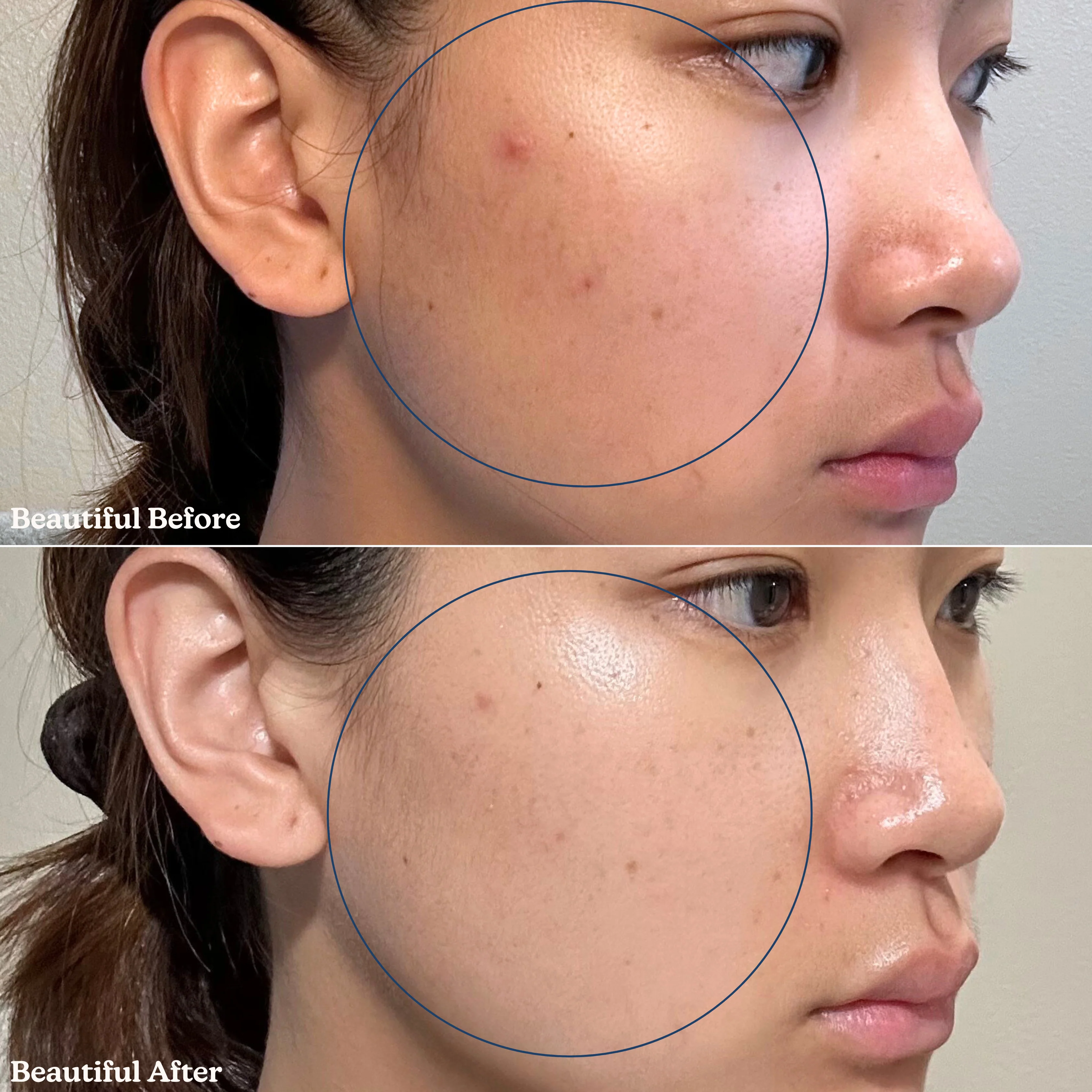 Pearl Drip Soothing + Hydration Milky Toner - Image 10