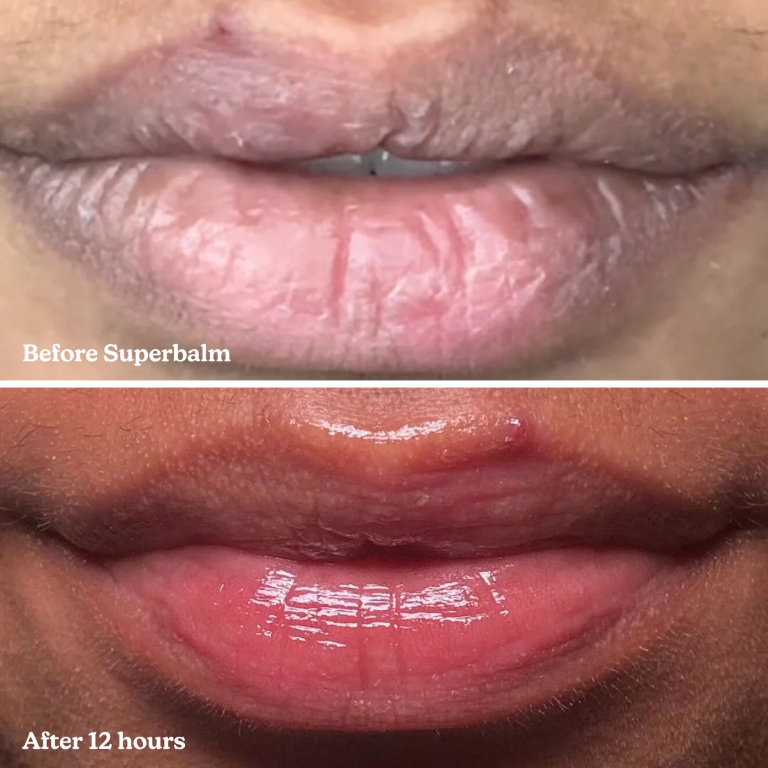 Superbalm Tripeptide-1 Vanilla Lip Balm - Image 11
