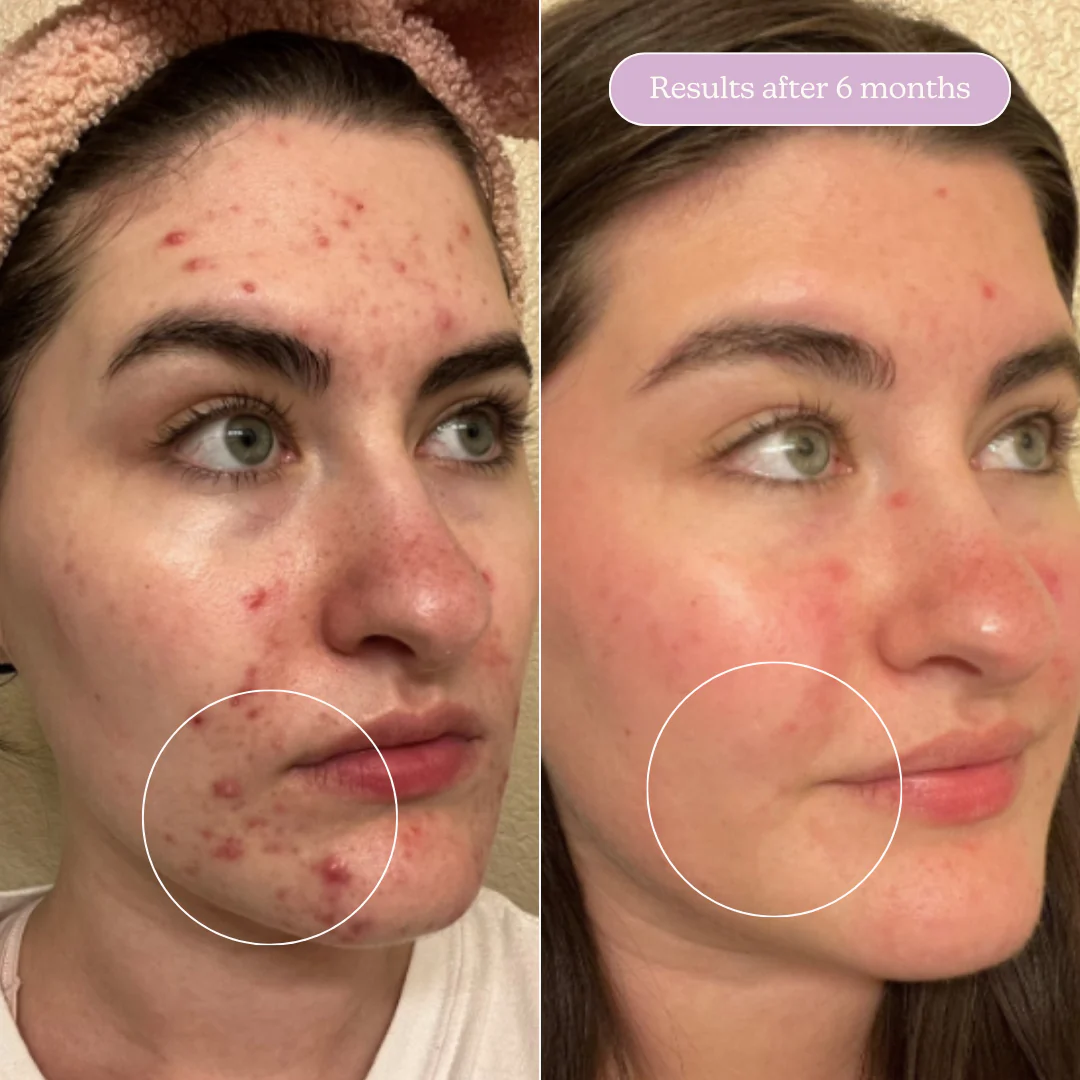 The Ultimate Clear Skin Edit - Image 17