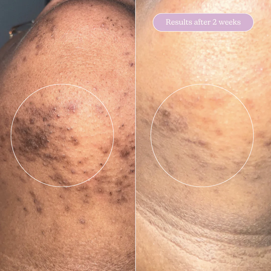 The Ultimate Clear Skin Edit - Image 24