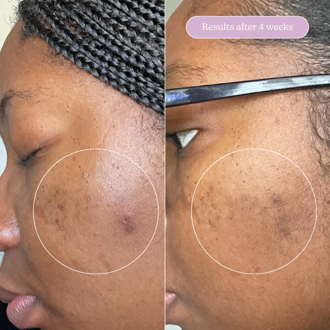 The Ultimate Clear Skin Edit - Image 25