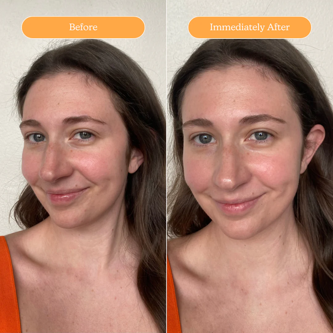 The Ultimate Clear Skin Edit - Image 32