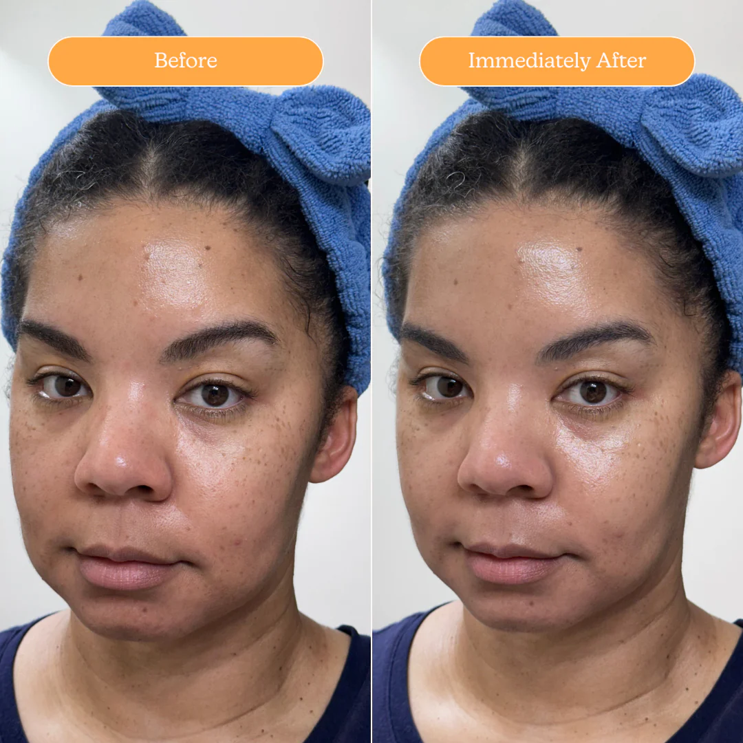 The Ultimate Clear Skin Edit - Image 33