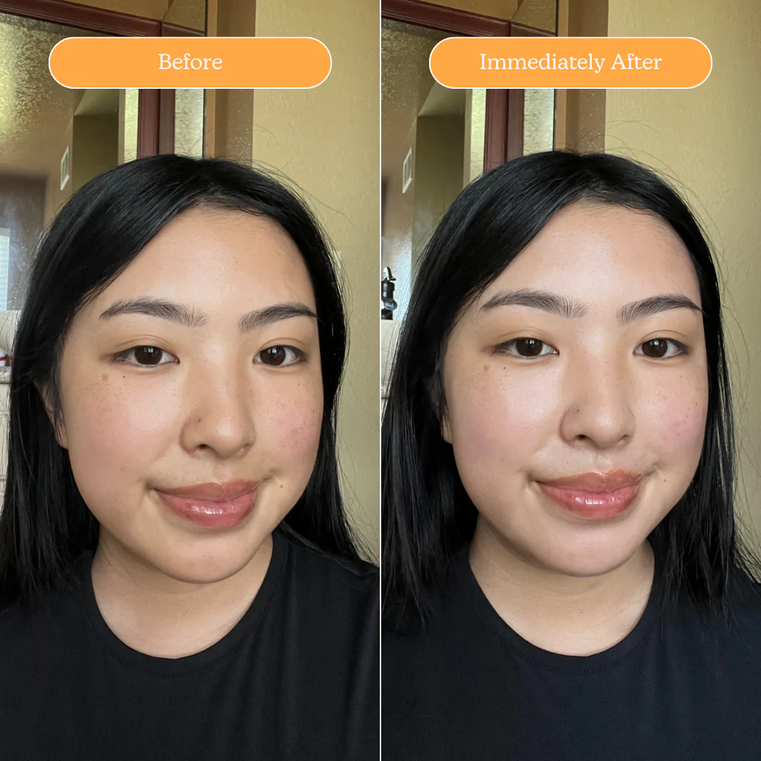 The Ultimate Clear Skin Edit - Image 34